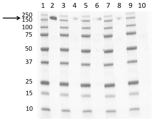 Anti Human CD163 Antibody, clone EDHu-1 gallery image 26