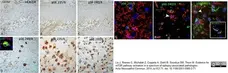 Anti Human CD163 Antibody, clone EDHu-1 gallery image 27