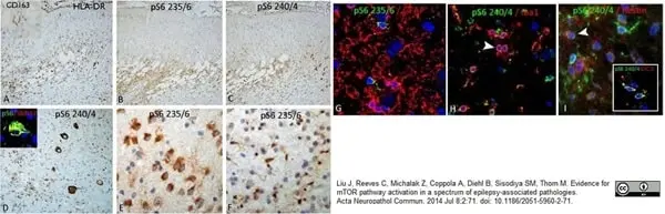 Anti Human CD163 Antibody, clone EDHu-1 gallery image 27