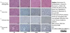 Anti Human CD163 Antibody, clone EDHu-1 gallery image 31