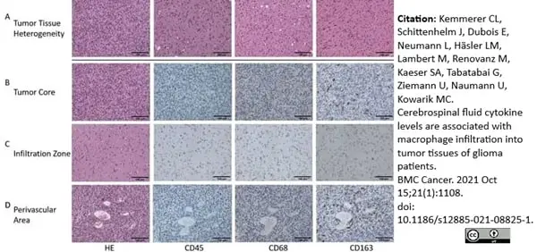Anti Human CD163 Antibody, clone EDHu-1 gallery image 31