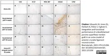 Anti Human CD163 Antibody, clone EDHu-1 gallery image 32