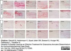 Anti Human CD163 Antibody, clone EDHu-1 gallery image 37