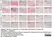 Anti Human CD163 Antibody, clone EDHu-1 thumbnail image 37