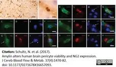 Anti Human CD163 Antibody, clone EDHu-1 gallery image 4
