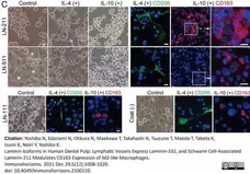 Anti Human CD163 Antibody, clone EDHu-1 gallery image 41