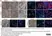 Anti Human CD163 Antibody, clone EDHu-1 thumbnail image 41