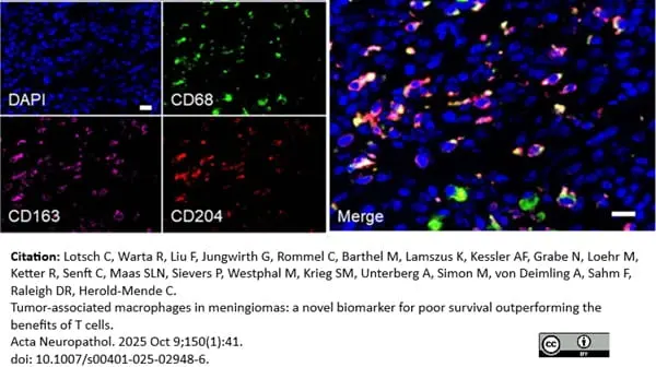 Anti Human CD163 Antibody, clone EDHu-1 gallery image 49