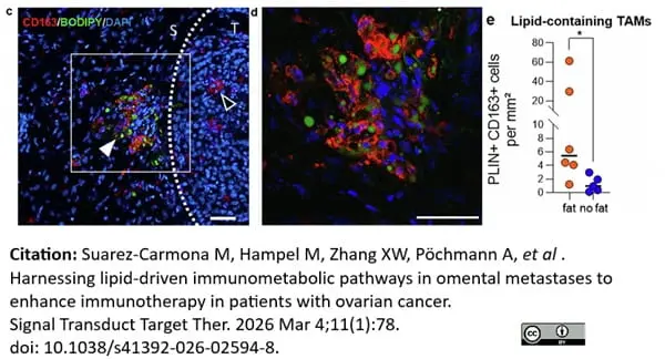 Anti Human CD163 Antibody, clone EDHu-1 gallery image 51