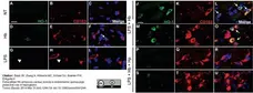 Anti Human CD163 Antibody, clone EDHu-1 gallery image 6