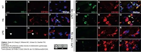 Anti Human CD163 Antibody, clone EDHu-1 gallery image 6