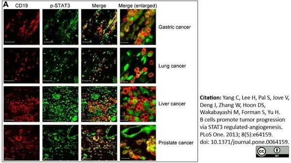 Anti Human CD19 Antibody, clone LT19 gallery image 14