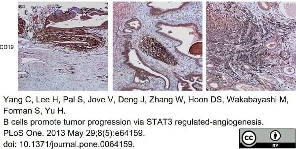 Anti Human CD19 Antibody, clone LT19 gallery image 16