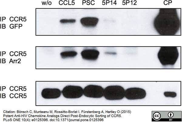 Anti Human CD195 Antibody, clone HEK/1/85a gallery image 1