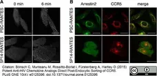 Anti Human CD195 Antibody, clone HEK/1/85a gallery image 2