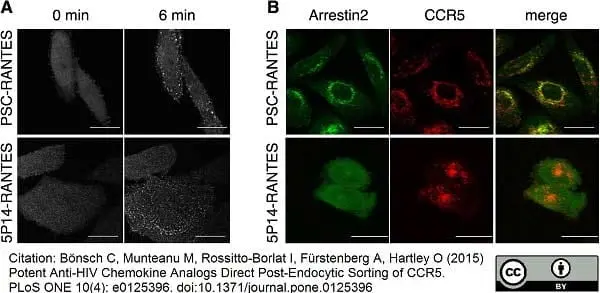 Anti Human CD195 Antibody, clone HEK/1/85a gallery image 2