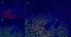 Anti Human CD1a Antibody, clone NA1/34-HLK gallery image 10