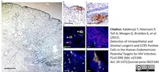 Anti Human CD1a Antibody, clone NA1/34-HLK gallery image 13