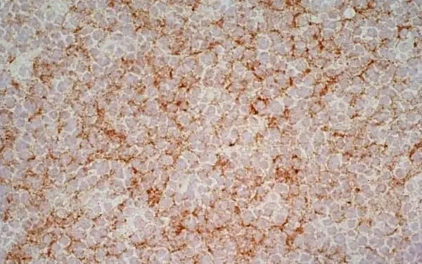Anti Human CD1a Antibody, clone NA1/34-HLK gallery image 7