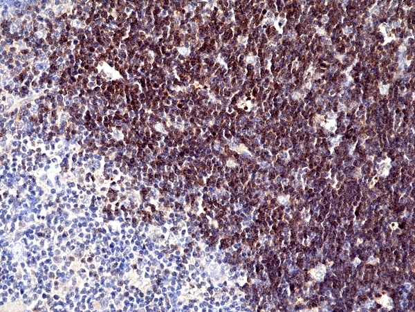 Anti CD1a Antibody, clone RM393 gallery image 1