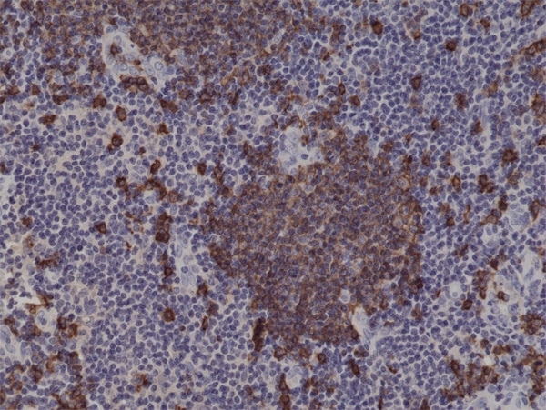 Anti CD20 Antibody, clone RM272 gallery image 2