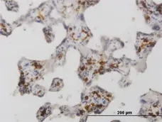 Anti Human CD206 Antibody, clone 5C11 gallery image 1