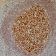 Anti Human CD21 Antibody, clone 2G9 gallery image 1