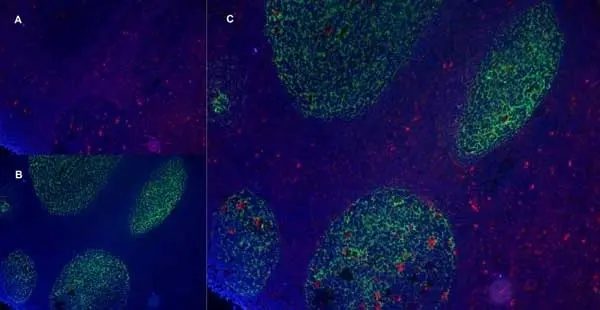 Anti Human CD21 Antibody, clone LB21 gallery image 10