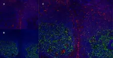 Anti Human CD21 Antibody, clone LB21 gallery image 11