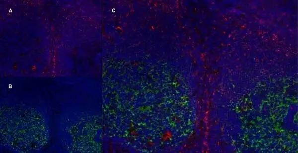 Anti Human CD21 Antibody, clone LB21 gallery image 11