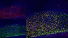 Anti Human CD21 Antibody, clone LB21 gallery image 2