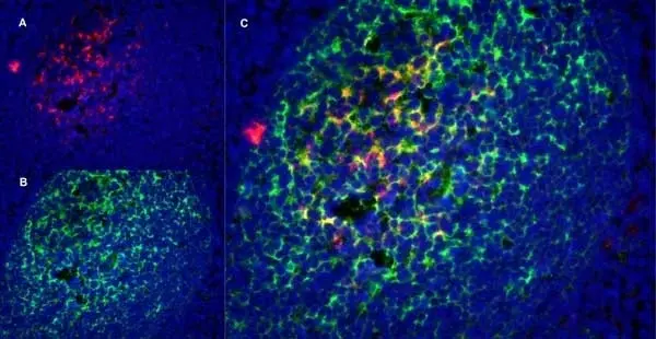 Anti Human CD21 Antibody, clone LB21 gallery image 3