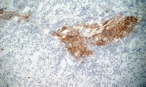 Anti Human CD21 Antibody, clone LB21 gallery image 4