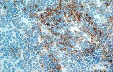Anti Human CD21 Antibody, clone LB21 gallery image 5