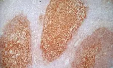 Anti Human CD21 Antibody, clone LB21 gallery image 6