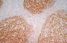 Anti Human CD21 Antibody, clone LB21 gallery image 7
