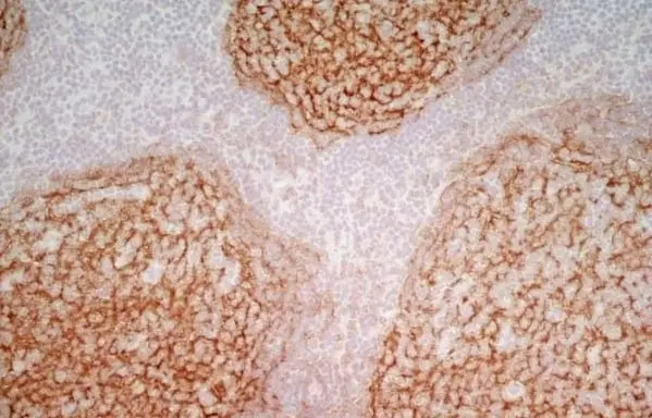 Anti Human CD21 Antibody, clone LB21 gallery image 7