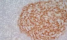 Anti Human CD21 Antibody, clone LB21 gallery image 8