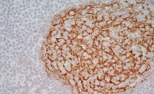 Anti Human CD21 Antibody, clone LB21 gallery image 8