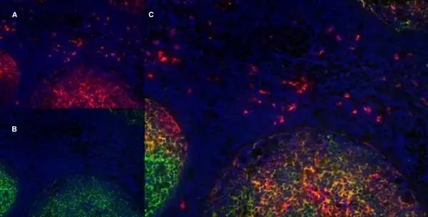 Anti Human CD21 Antibody, clone LB21 gallery image 9