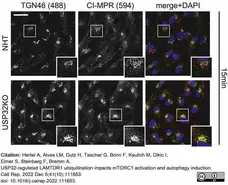 Anti Human CD222 Antibody, clone MEM-238 gallery image 3