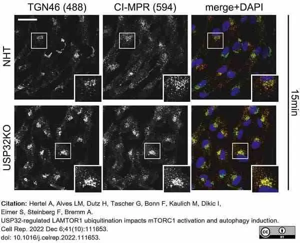 Anti Human CD222 Antibody, clone MEM-238 gallery image 3