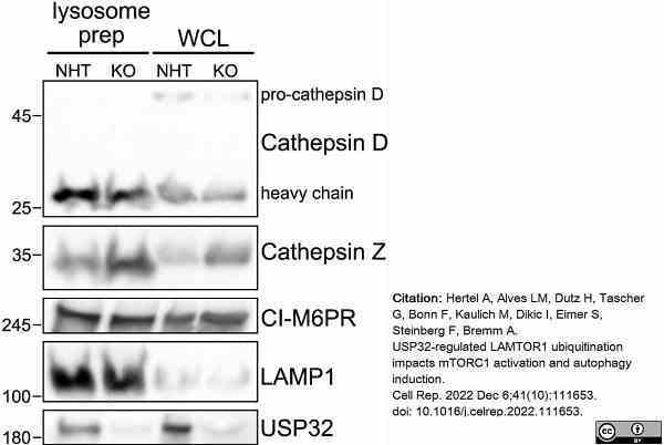 Anti Human CD222 Antibody, clone MEM-238 gallery image 4