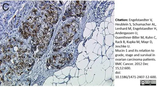 Anti Human CD227 Antibody, clone VU-3C6 gallery image 2