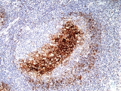 Anti CD23 Antibody, clone RM406 gallery image 2