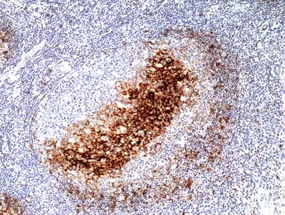 Anti CD23 Antibody, clone RM406 gallery image 2
