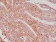 Anti CD276 Antibody, clone RM335 gallery image 2