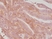 Anti CD276 Antibody, clone RM335 thumbnail image 2