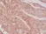 Anti CD276 Antibody, clone RM335 thumbnail image 2