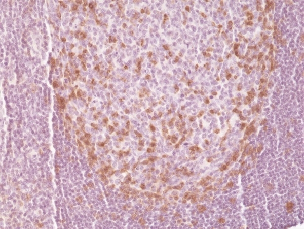 Anti CD279 Antibody, clone RM309 gallery image 2